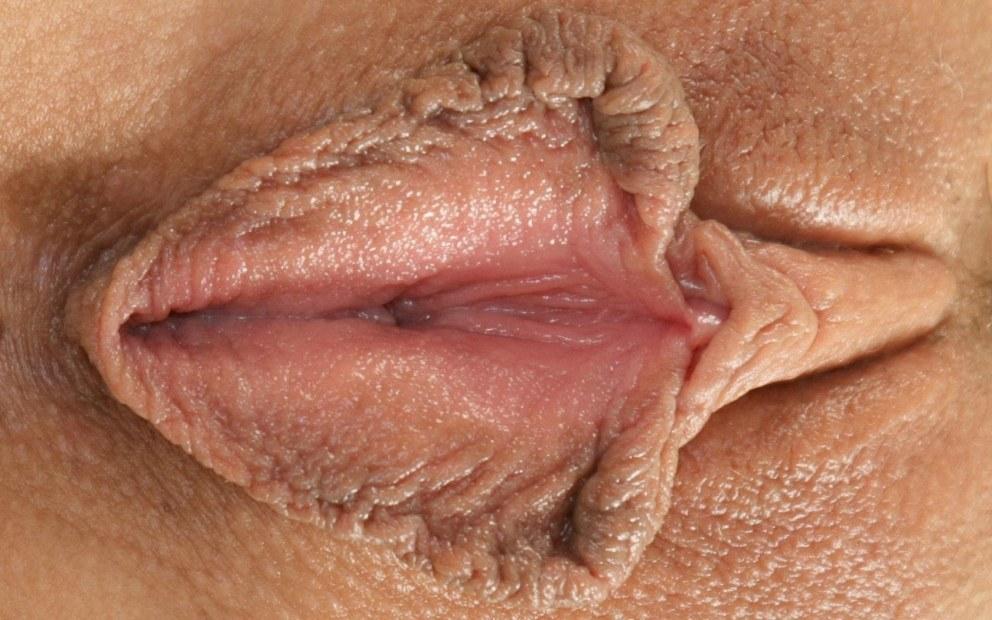 Самые некрасивые вагины
